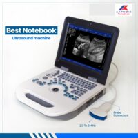Ultrasound Machine with Convex Probe Model: Nyro 10 Novadex (China)