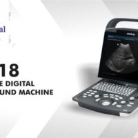Ultrasound Machine with Convex Probe Model: DP-18 Mindray (China)